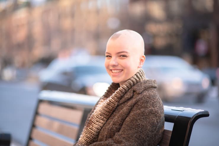 confira dicas de como lidar psicologicamente com a alopecia areata