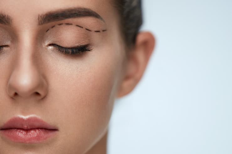 conheça e saiba mais sobre a blefaroplastia aliada à toxina botulínica e harmonização facial