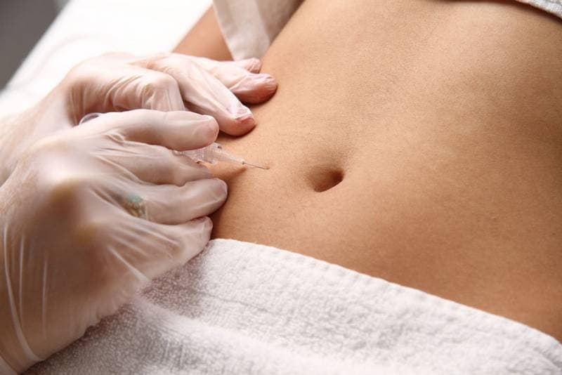 procedimento carboxiterapia