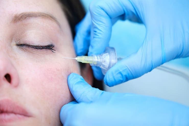 conheça o procedimento de carboxiterapia