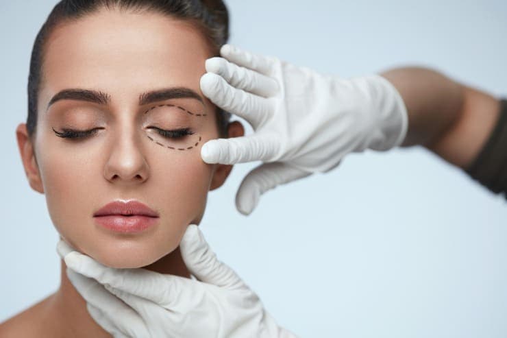 cuidados pós blefaroplastia