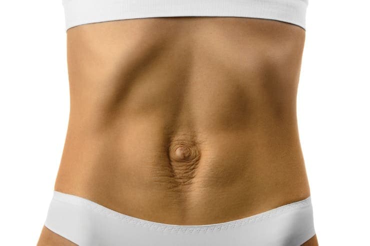 tratamentos para diástase abdominal