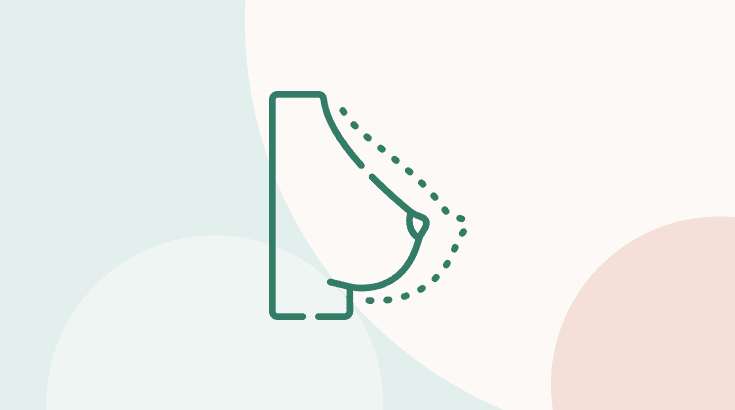 Explante Mamário: o que é e a quem se destina