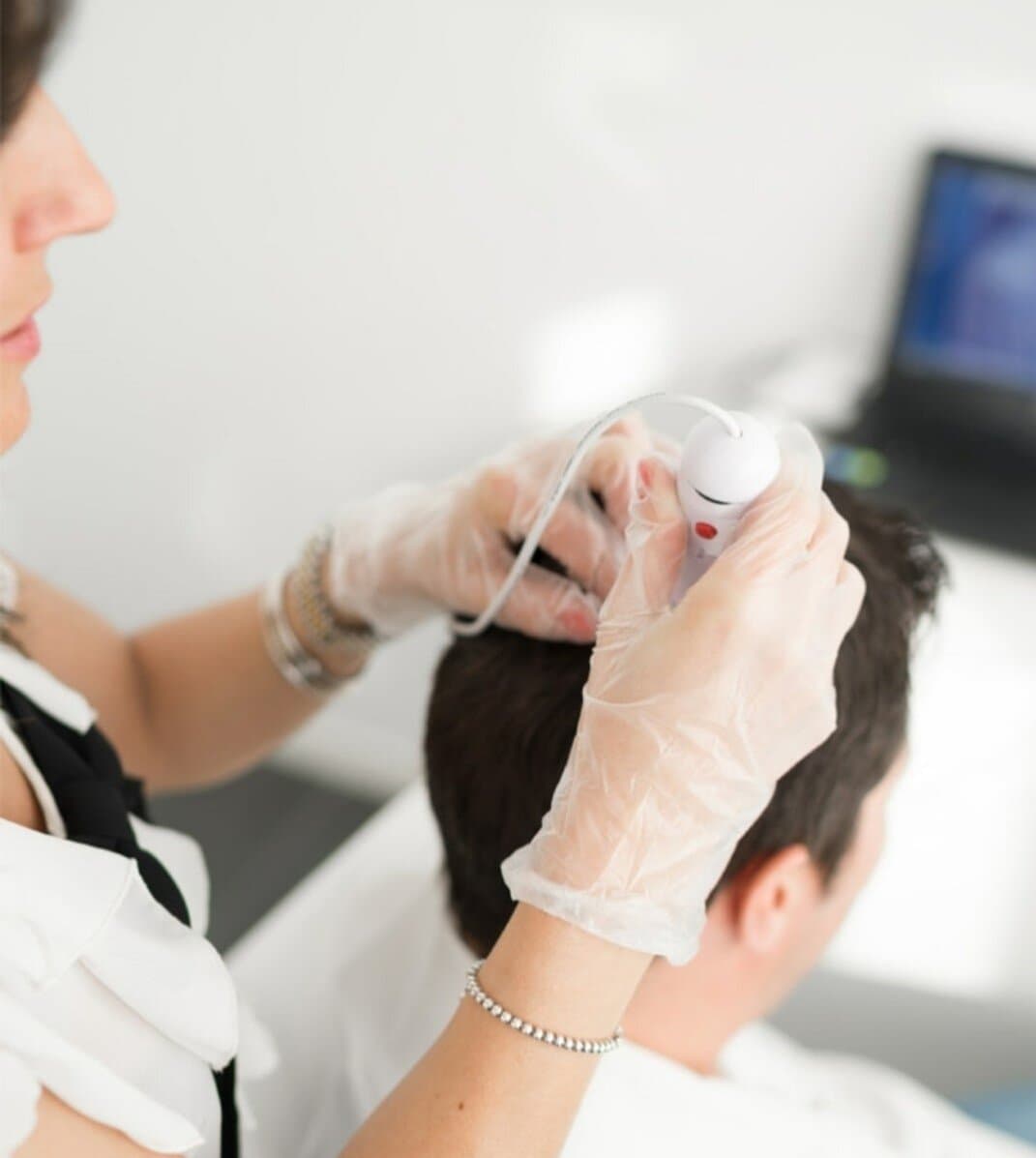 Transplante capilar: 6 mitos e verdades a respeito dessa técnica