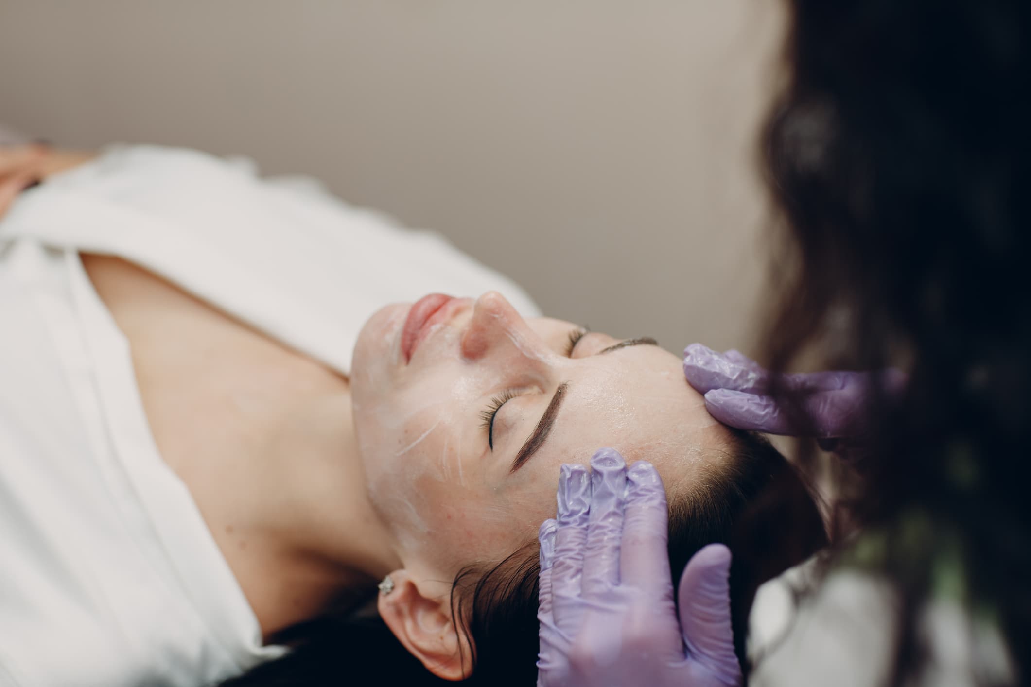 peeling quimico para renovação da pele