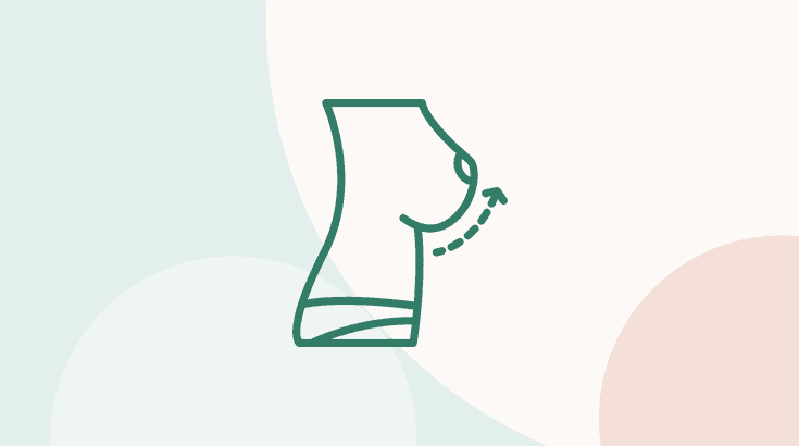 Mamoplastia de Aumento: tire todas as suas dúvidas