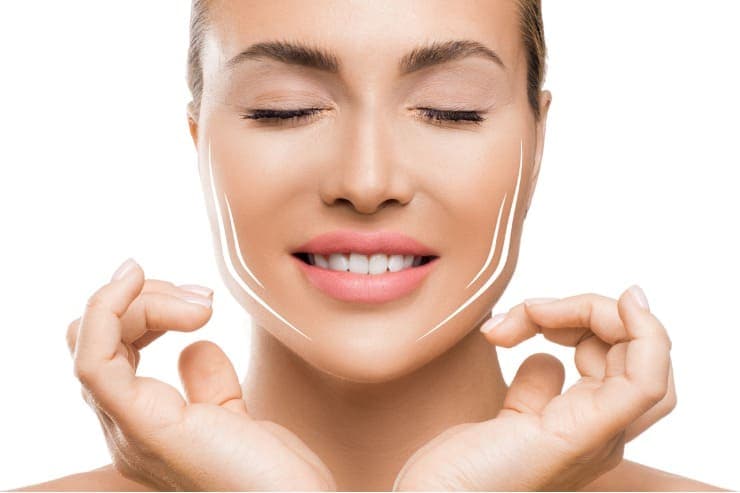 vantagens do lifting com fios de Polidioxanona