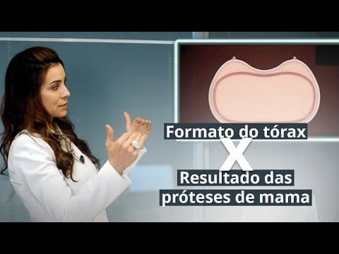 PRÓTESES DE MAMA: O formato do seu tórax pode mudar completamente o resultado!