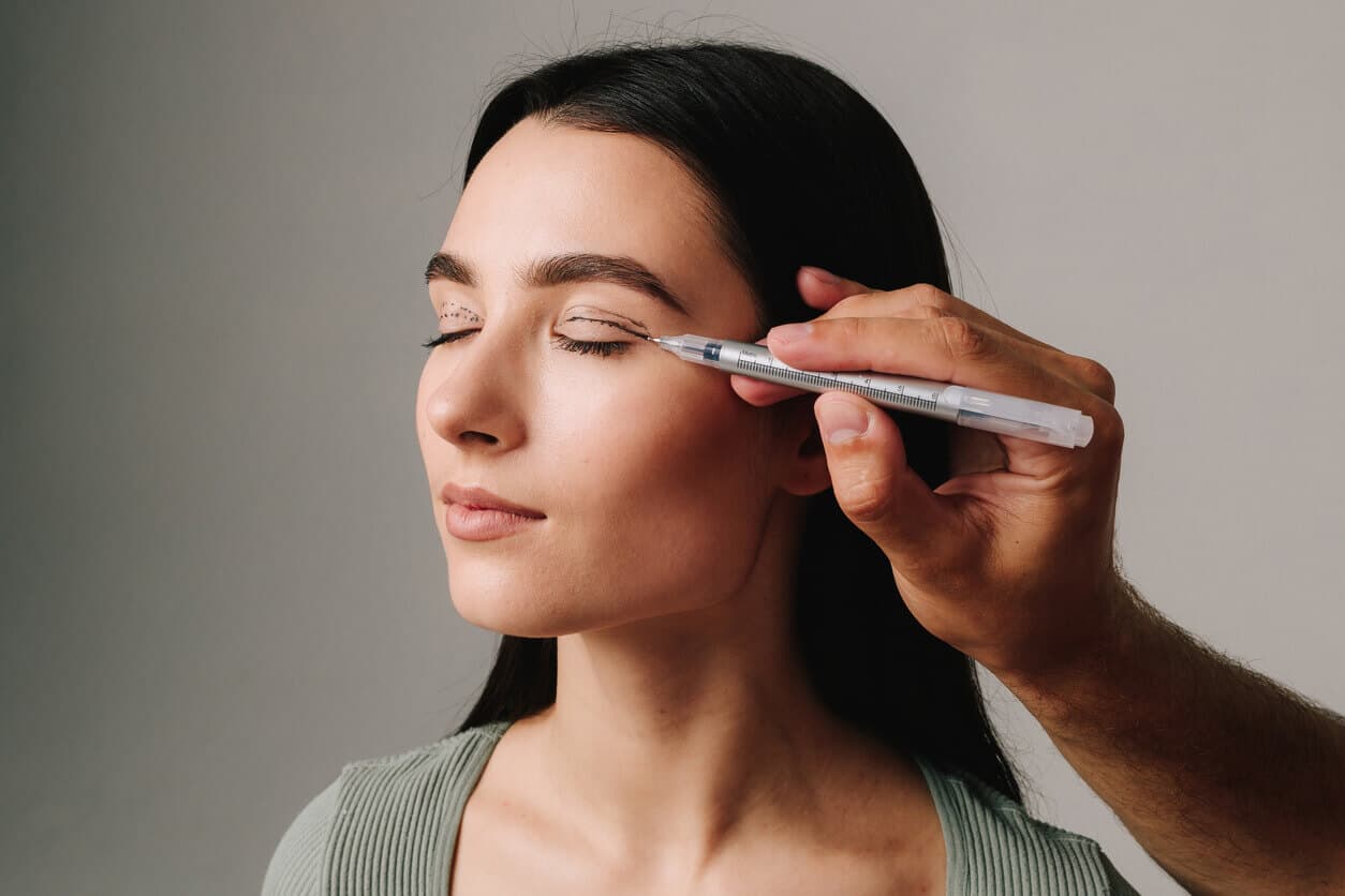 Médico realizando marcação nas pálpebras de uma paciente antes da blefaroplastia