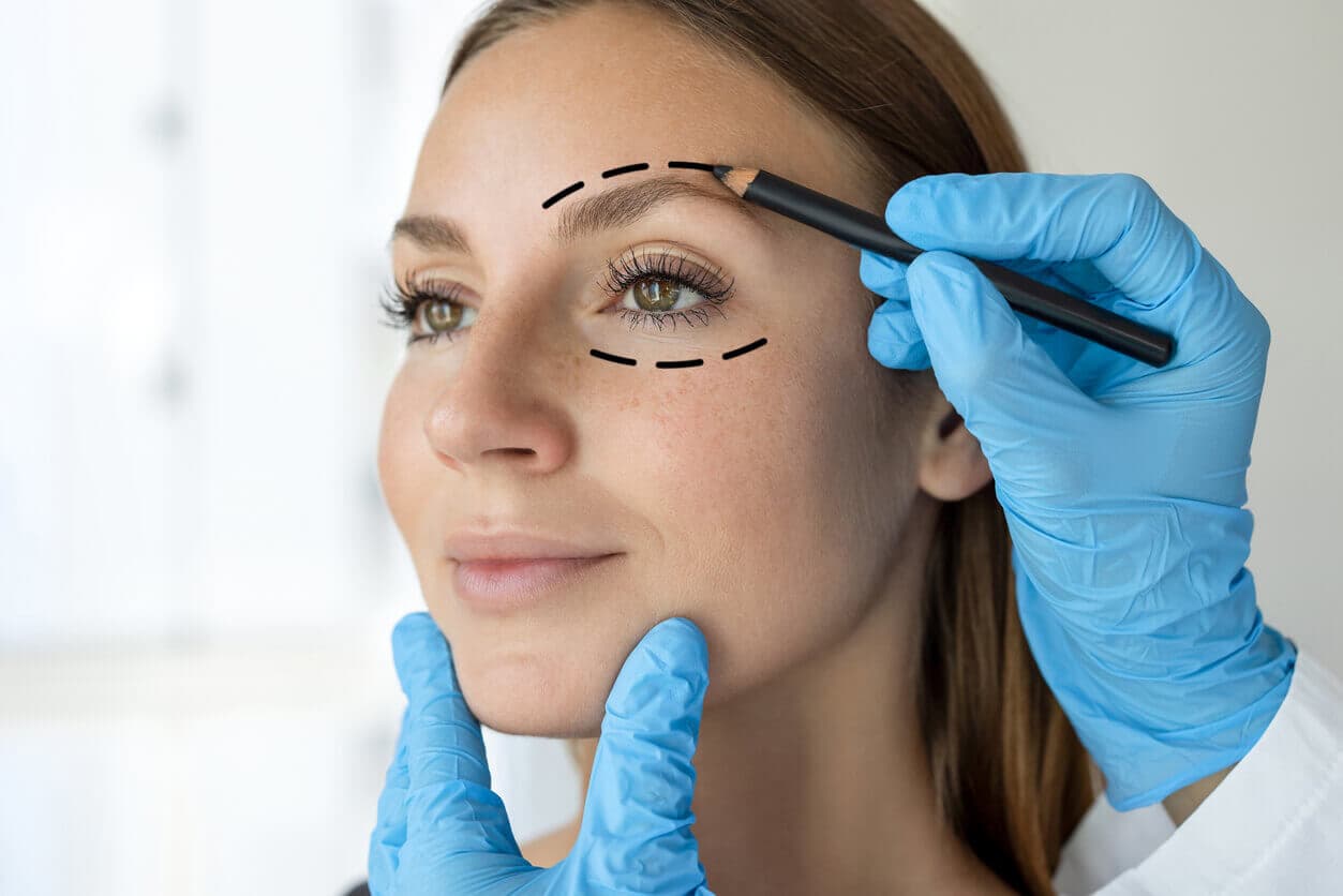 Mulher jovem com marcações ao redor dos olhos feitas por um médico cirurgião