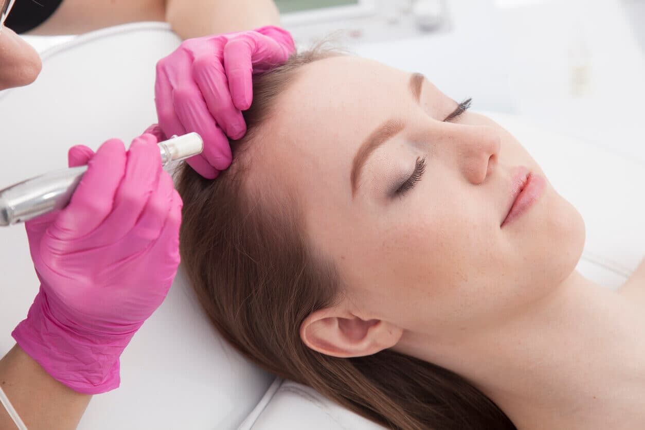 Paciente do sexo feminina durante procedimento capilar injetável