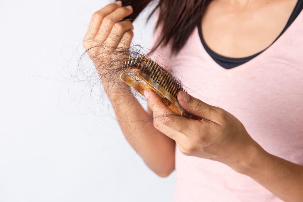 Mulher segurando um tufo de cabelo, sinal comum de calvície feminina