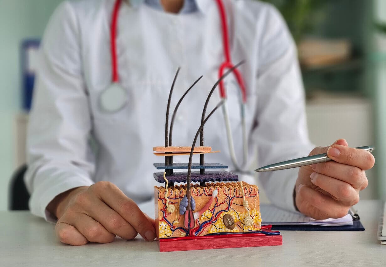 Especialista em transplante capilar mostra modelo do couro cabeludo para explicar como ocorre o crescimento dos fios.