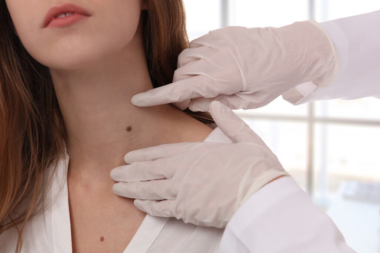 Paciente feminina durante consulta médica com dermatologista, que analisa suas pintas no pescoço