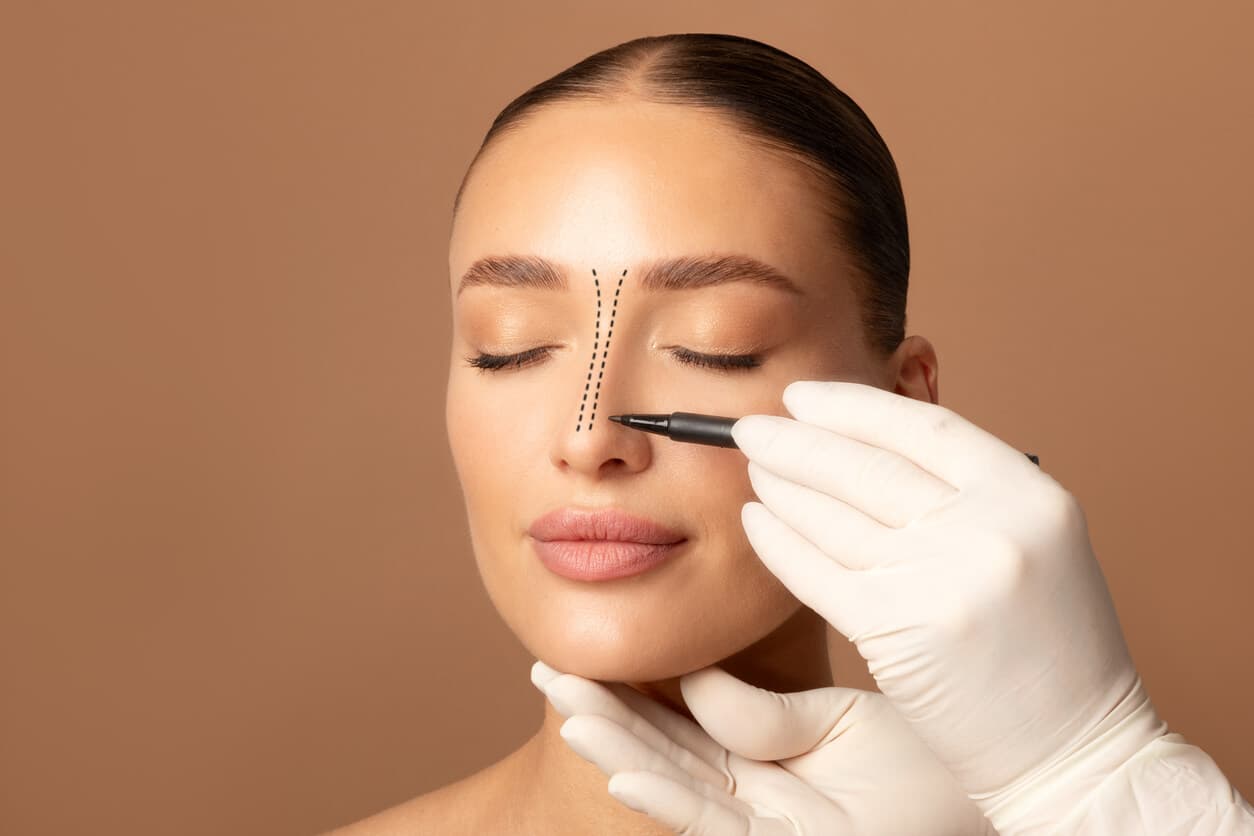 Mãos enluvadas de um profissional médico realizando marcações no nariz de uma paciente do sexo feminino para o procedimento cirúrgico de rinoplastia