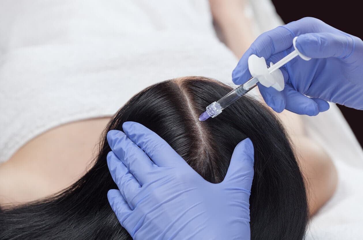 Close do couro cabeludo de uma paciente durante sessão de terapia capilar injetável