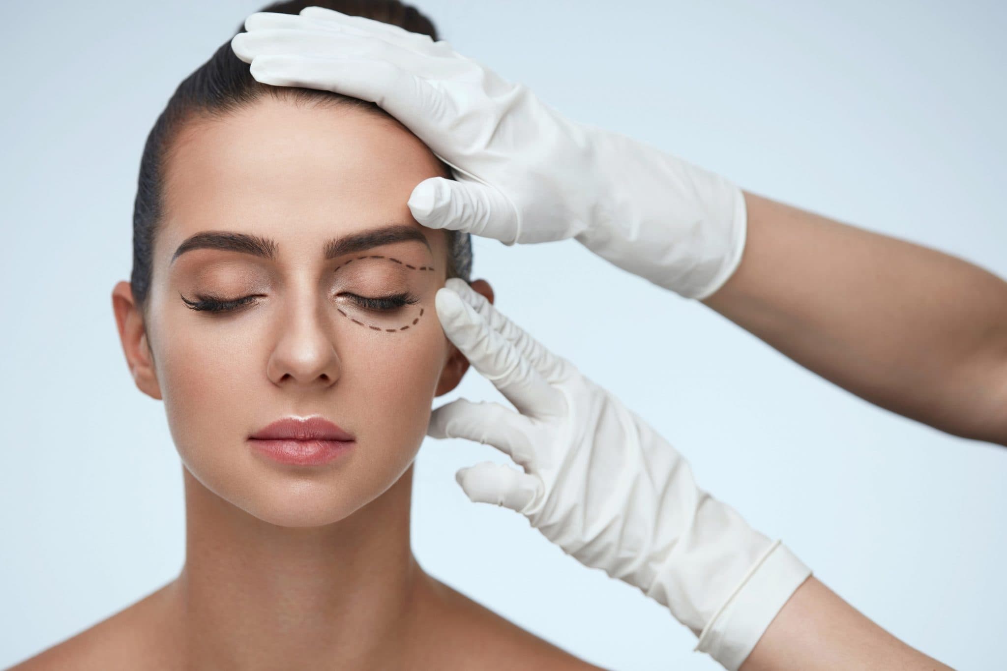 Como é a cirurgia de blefaroplastia?