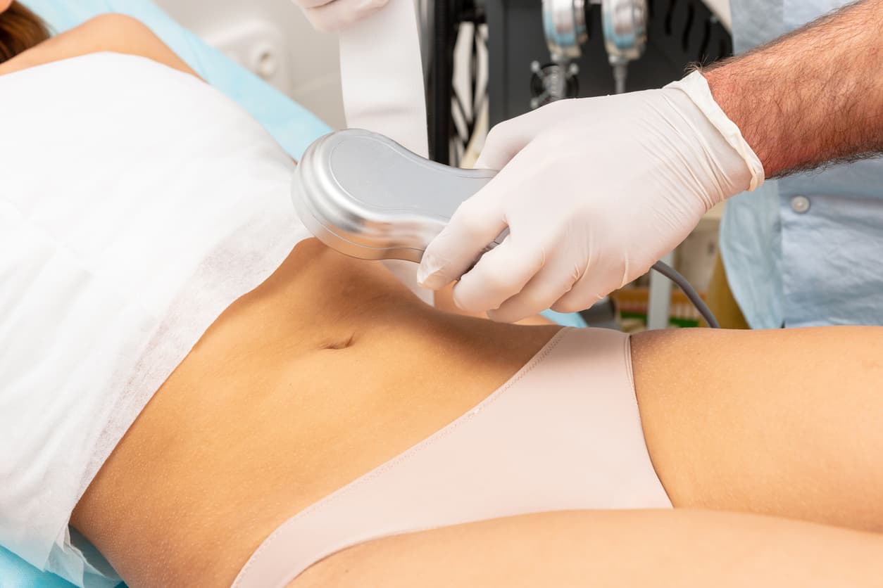 cicatrização da abdominoplastia