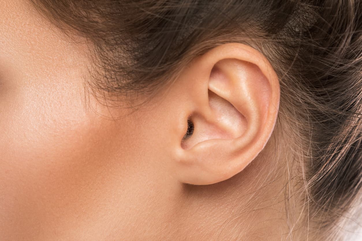 resultado da otoplastia