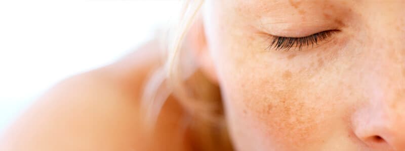 Câncer de Pele Cuidados